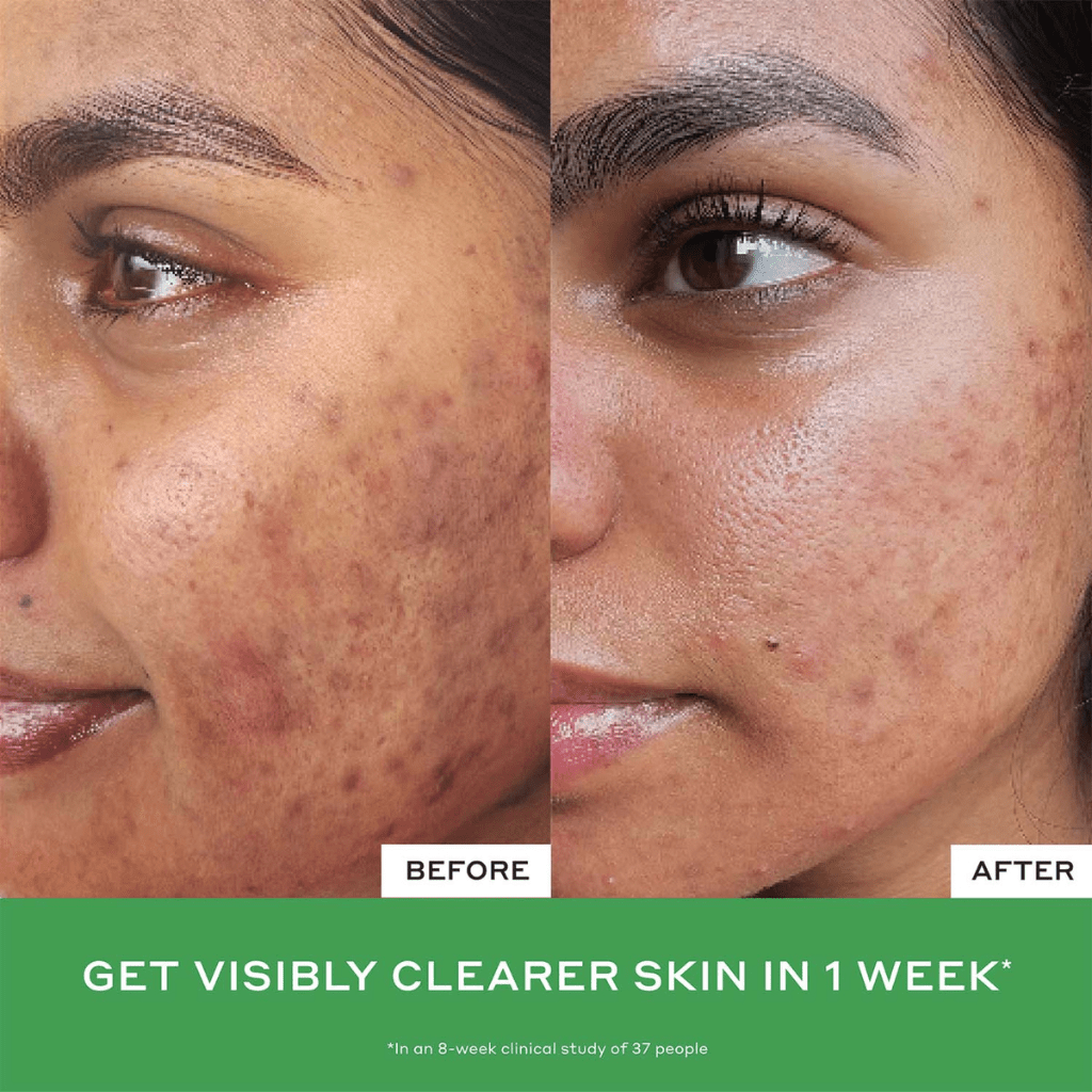 449-ole-henriksen-daily-d-clog-pore-clearing-cleanser-7.png Ole Henriksen Daily D-Clog Pore-Clearing Cleanser